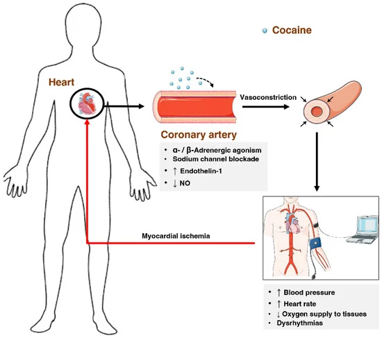 A visual representation of the metabolism of cocaine in the body.